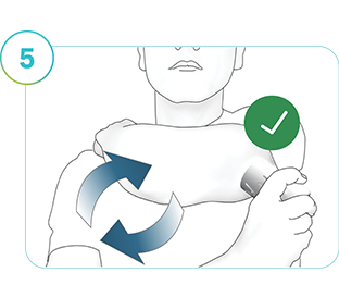 Bilden visar en person som applicerar en ny SmartGuide-sensor på ett nytt ställe.