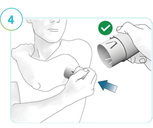 Illustration av steg 4: En person som använder applikatorn för att föra in CGM på det preparerade applikationsstället.