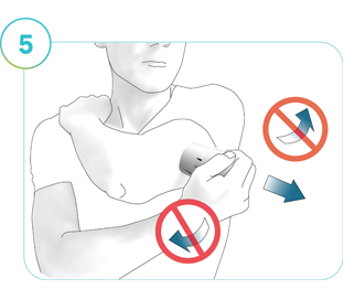 Illustration av steg 5: Riktningen för att ta bort applikatorn från applikationsstället.