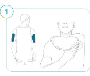 Illustration av steg 1: Applikationsställen markerade på baksidan av båda armarna, en illustration av en person som torkar av applikationsstället.